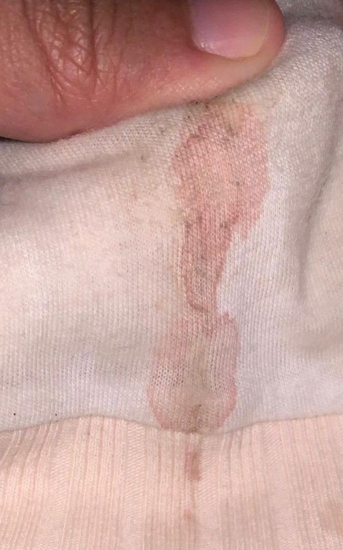 Perlu ke hospital tak ?