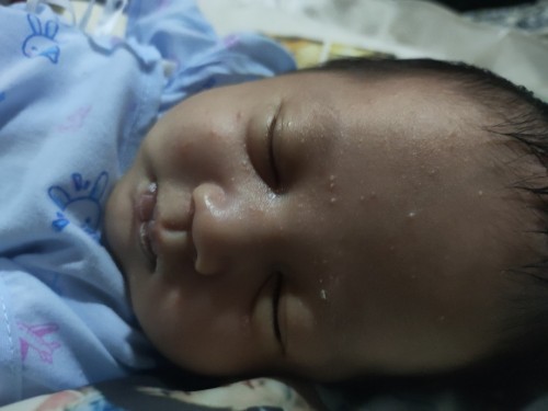 ขอสอบถามแม่ๆเรื่องผดลูกหน่อยค่ะ