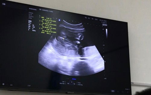 30+1week ทีมเมษา66