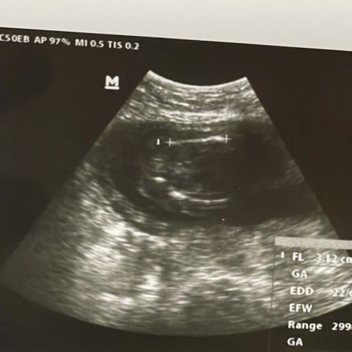 seneng banget abis usg