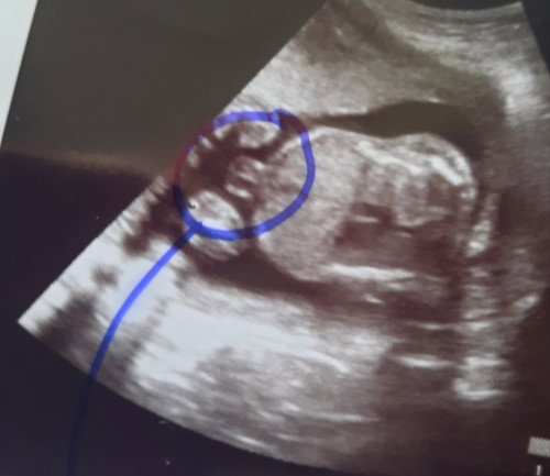 Jantina bayi