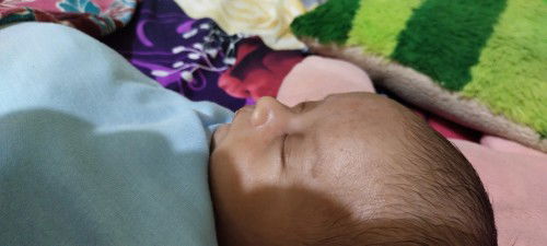 Bintik2 merah pada wajah bayi