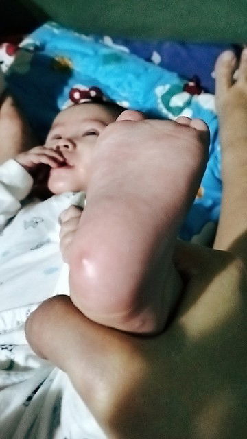 Phỏng phải không ạ