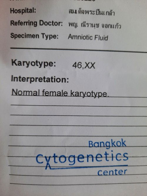 อายุ 42 หมอบอกเสี่ยง
สูงมากๆ