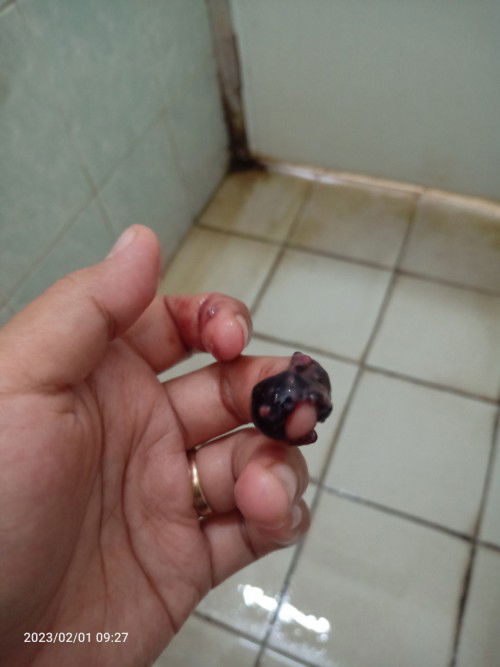 Keluar flek dan gumpalan darah