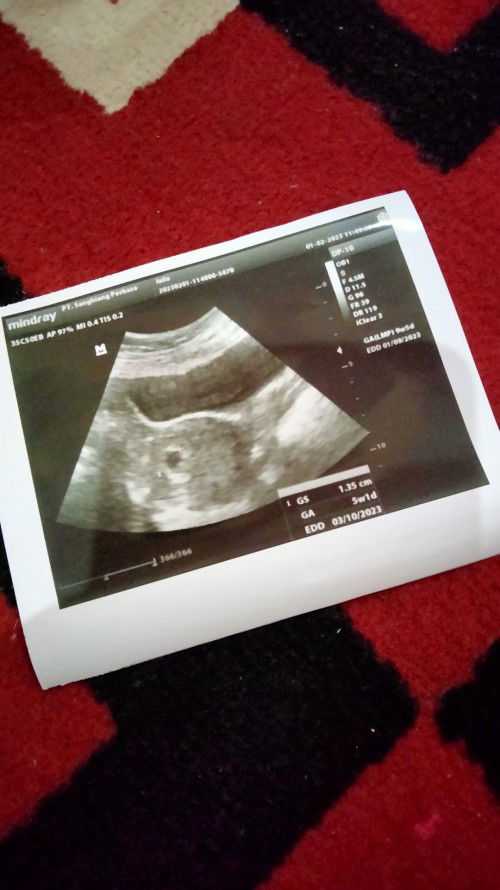 Htph 9 minggu tapi di layar usg baru berusia 5 minggu, normal gak bund?