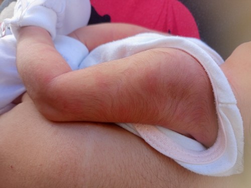 Pamumula ni baby, 5 days palnh po si baby