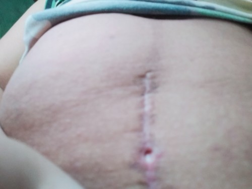 1/2 months CS mom