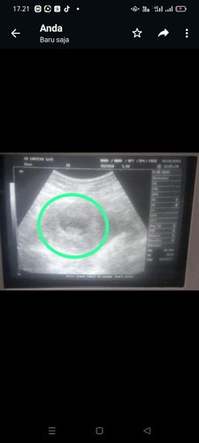 Sehat2 ya ..🥰🥰🥰🤲🤲..semoga sehat buat bunda2 semua..