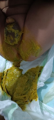 Green wth yellow poop