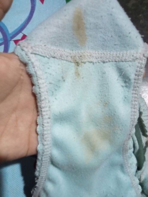 Ada yang pernah ngalamin engga Bun saya hamil 10 week keluar cairan gitu mohon dijawab yah bunda2