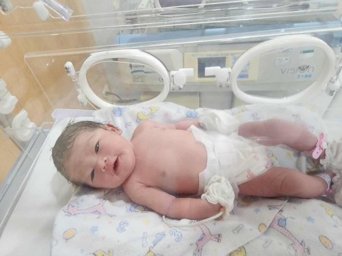 คลอดก่อนกำหนด