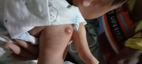 ฉีกวัคซีนก่อนออกโรงบาล