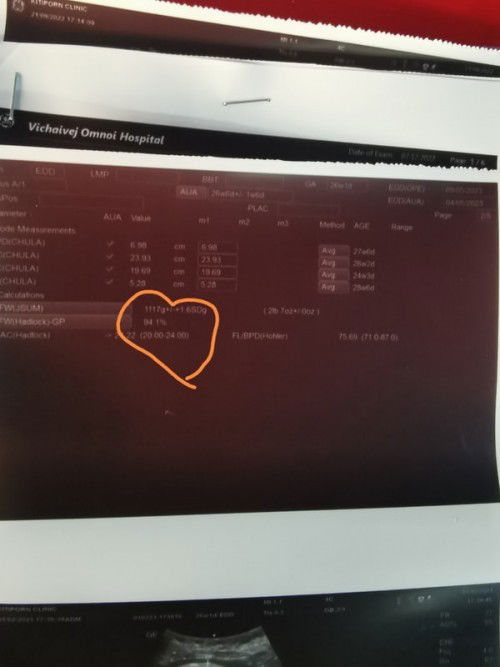 แม่ๆทีมพ.ค​ น้ำหนักน้องเท่าไหร่แล้วค่ะ​ บ้านนี้น้ำหนักน้องเยอะไปไหมว่าจะคลอดธรรมชาติกลัวลูกตัวใหญ่ไป