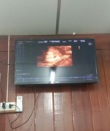 ขออนุญาตถามแม่ๆหน่อยค่ะ