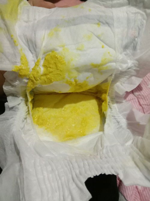 Feeding Formula Semilac Gold 0-6