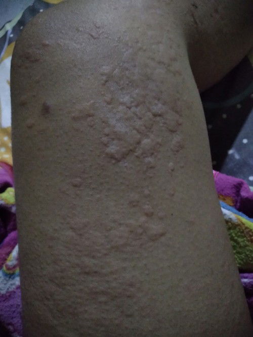 Mau tanya, ini kenapa ya? Gatal dan perih