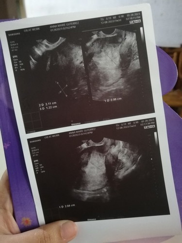 Normal po ba na kahit 7wks na si baby e di padin sya makita sa tranv ultrasound? Nag woworry po ako.
