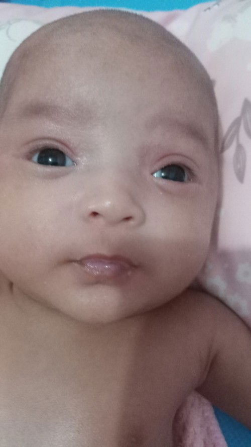 Dbagian kulit mata merah