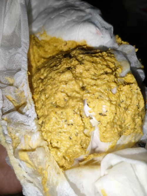 Bab bayi bercak hitam