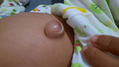 Bunn bayi sya pusarx sperti ini, ada yg tau gak kenapa? Cara ngatasix gimna