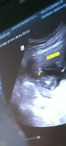 19 weeks gender