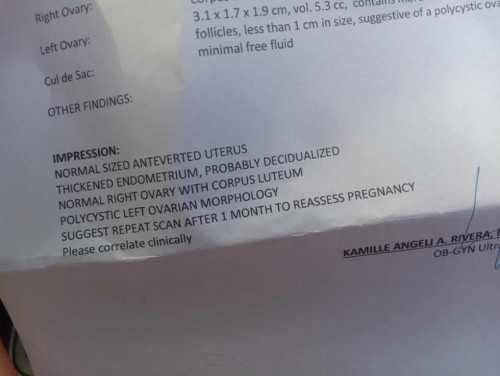 Buntis po ba ako ?