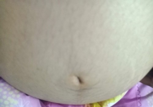 วันนี้แม่ตรวจปากมดลูก 36+5Wแม่ๆตรวจปากมดลูกกันกี่ วิกกันน้า