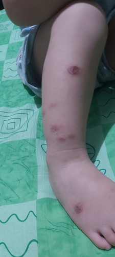Sugat ni Baby