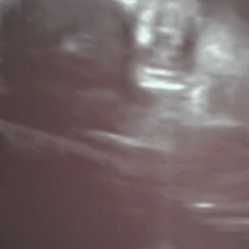 ช่วยอธิบายรูปให้หน่อย
ญ100%ใช่ใหม่ค่ะ