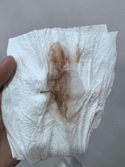 Tanda Bersalin atau Memang Macamni?