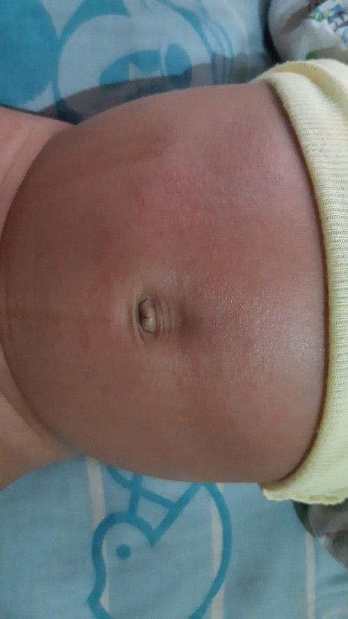 Ada yang ngalamin sama kaya anakku ga yaaj?