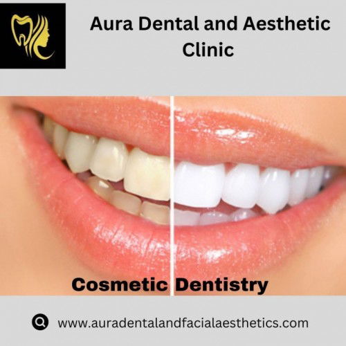 Who is the best dental clinic for cosmetic dentistry in Mogappair?