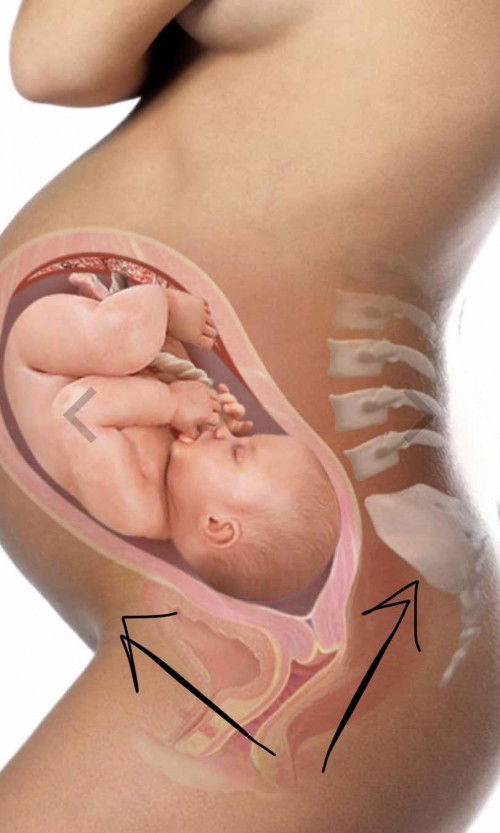 Sakit bahagian bawah