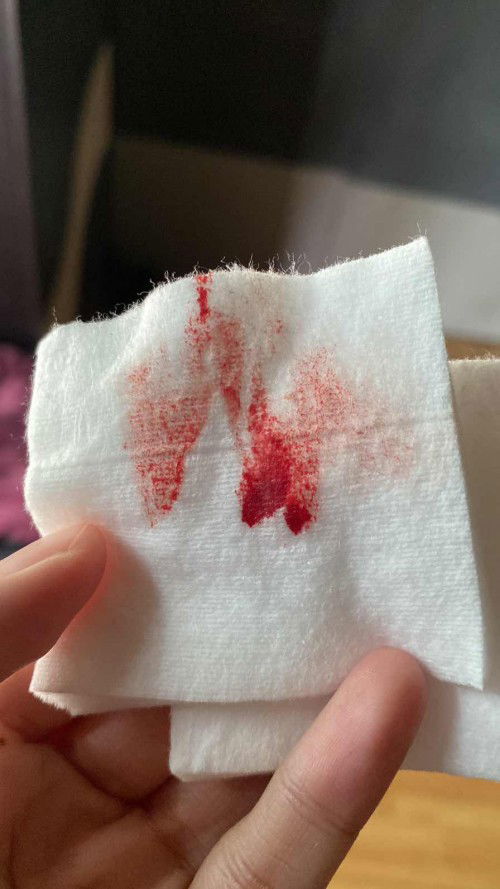 Keluar Flek di usia kehamilan 8w3d