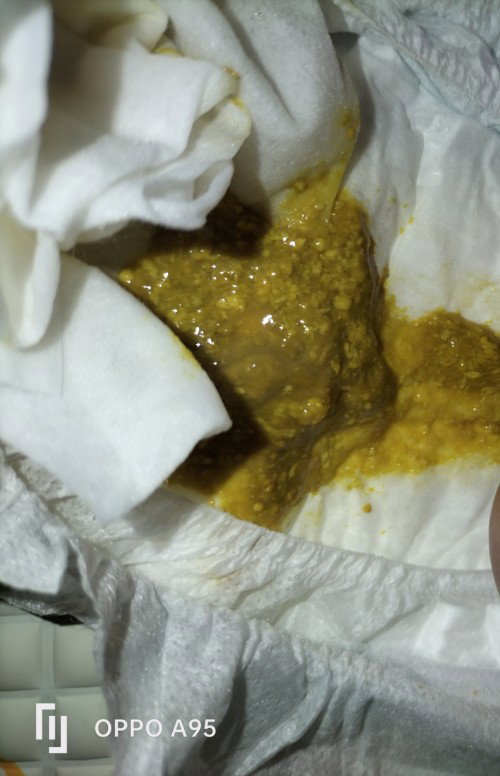 Najis Kuning Cair