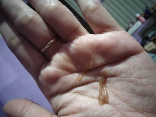 Kluar lendir usia kehamilan 30week