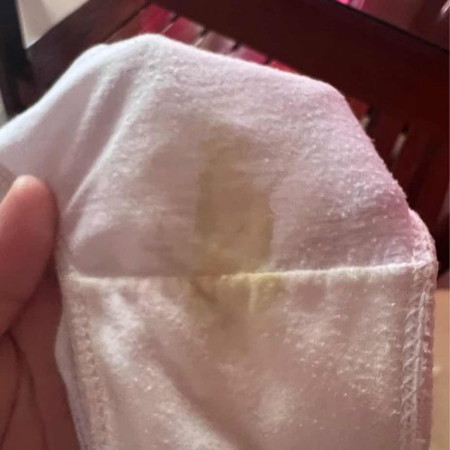 DISCHARGE at 37 weeks of pregnancy!