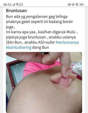 Belakang telinga berair