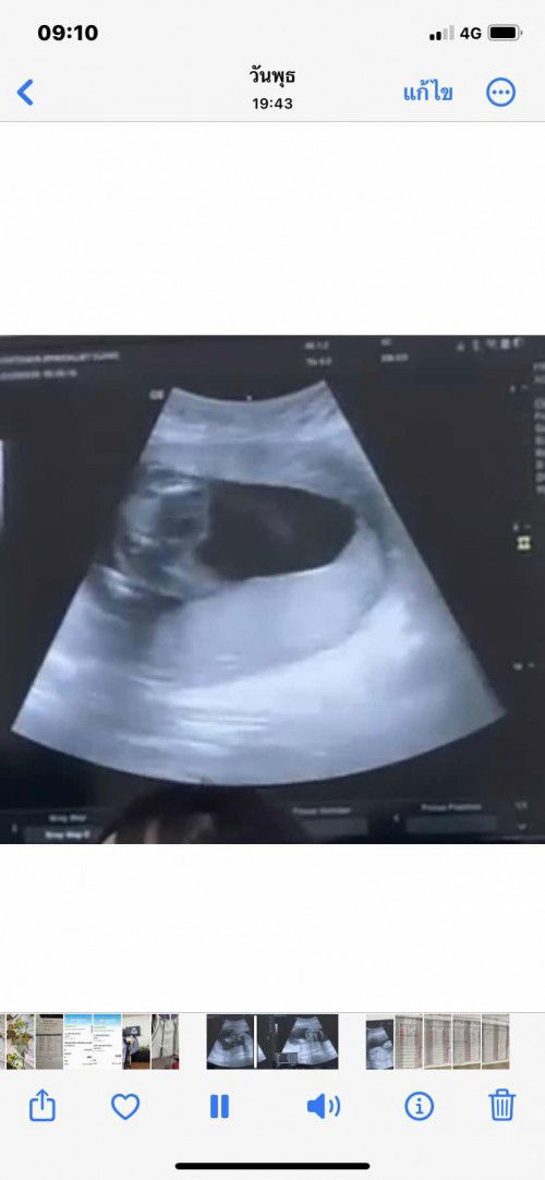 น้ำหนักลูก แม่ๆ 21w ลูกหนักกี่กรัม