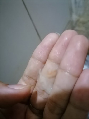 white discharge