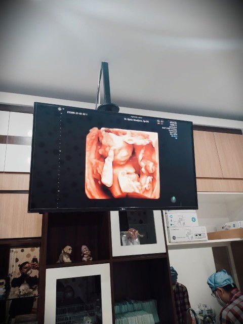 usg usia kandungan 19w