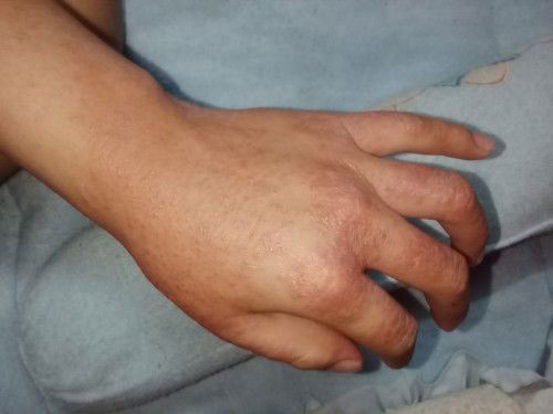 ขอนอกเรื่องหน่อยน่ะค่ะมีเป็นผื่นค่ะ