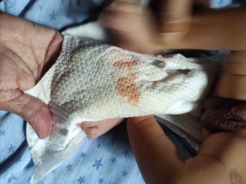 Kencing bayi baru lahir