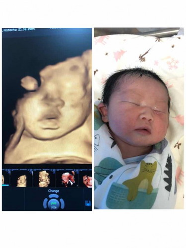 น้องมาแล้วค่าา🥰