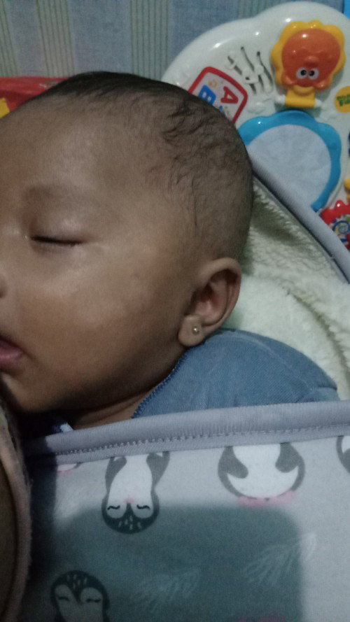 Diwajah ada bercak putih