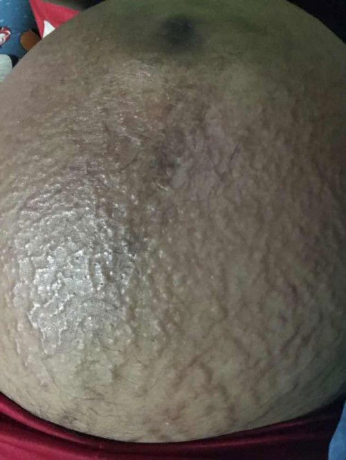 สอบถามแม่ๆหน่อยค่ะ