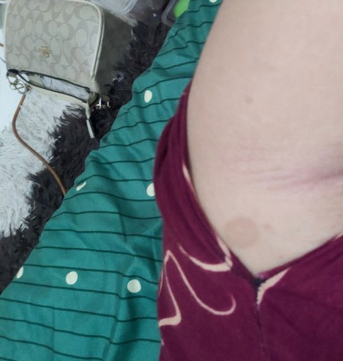 Bintik hitam di bagian badan.