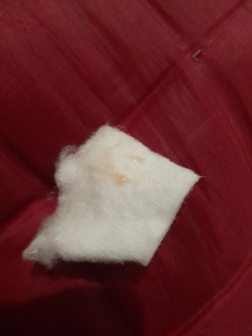 Flek/spotting uk 6 week, apakah normal?