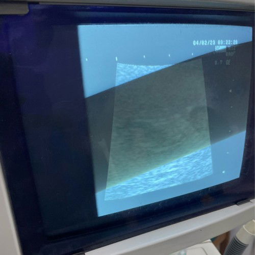 กล้องถ่ายขนานอันตซาว